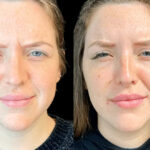 Top Reasons to Visit Best Aesthetic Clinics in Dubai for Botox
