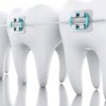 Social Media Content Ideas for Orthodontists image