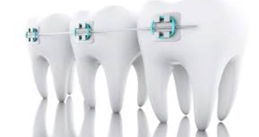 Social Media Content Ideas for Orthodontists image