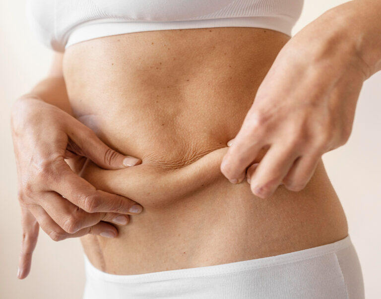 vaser liposuction in dubai