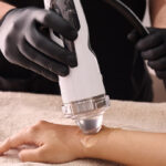 shockwave therapy in dubai