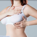breast augmentation