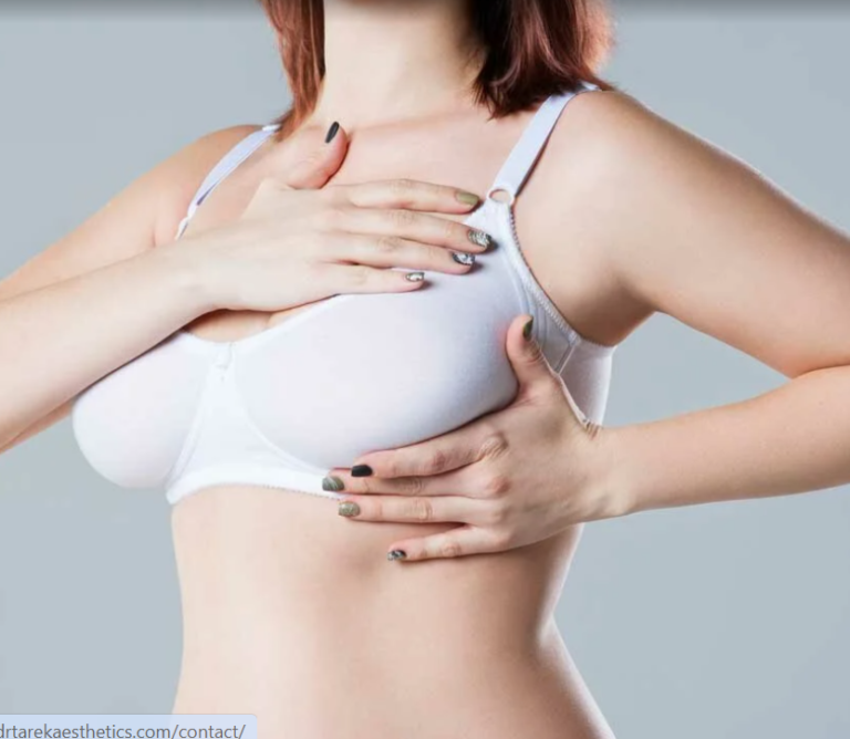 breast augmentation