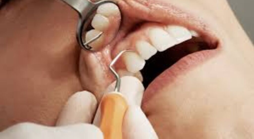 dental implant image