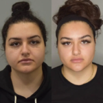Buccal Fat Removal in Dubai
