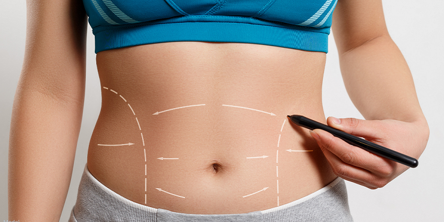 abdominoplasty in jeddah