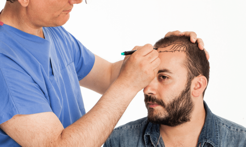 stem-cell-hair-transplant-1200x720