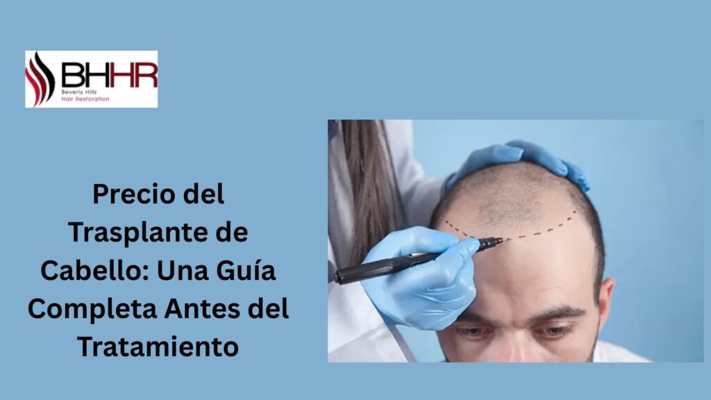 trasplante de cabello precio