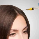 prp-treatment-1