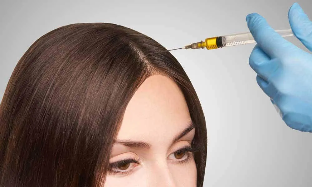 prp-treatment-1