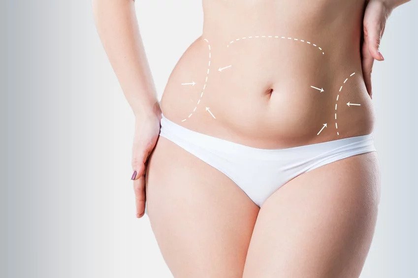 Tummy-Tuck-Surgery-in-Mumbai