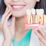 implant