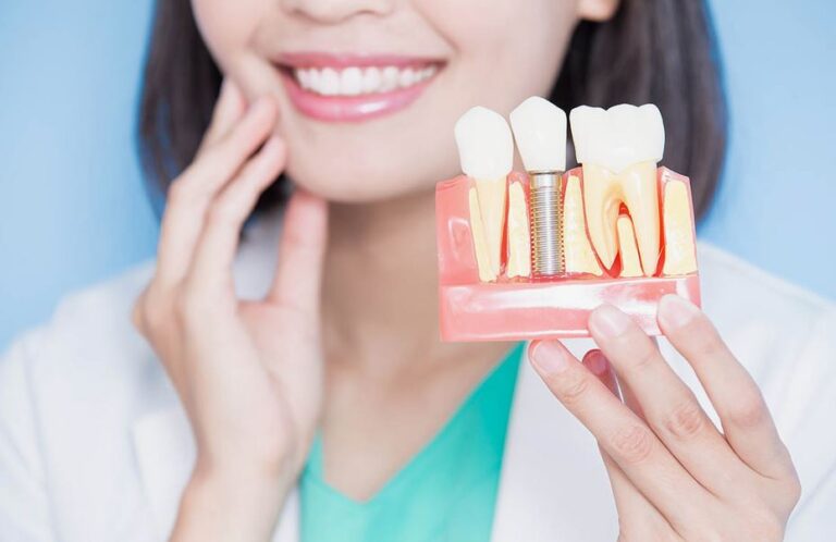 implant