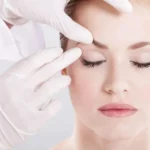 blepharoplasty in dubai