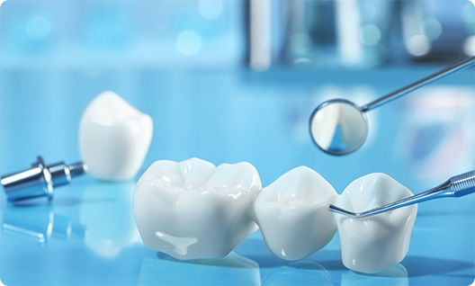Improve Your Smile with Reliable Dental Bridges Little Rock AR