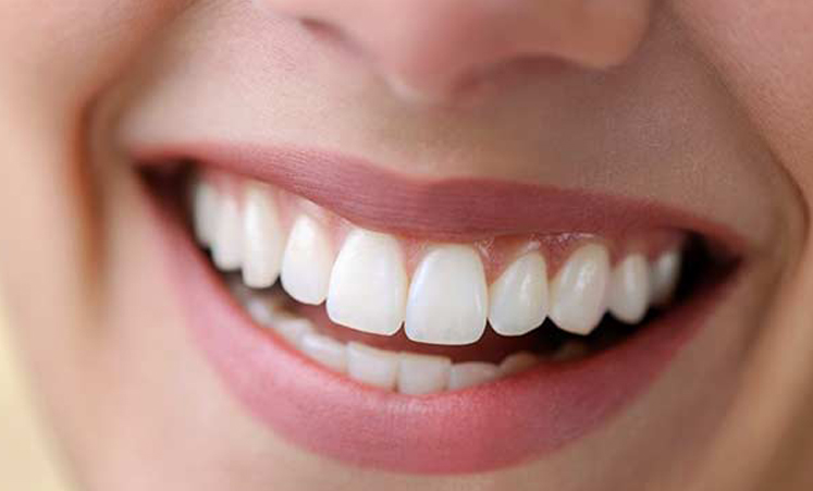 Dental Implants Cantonment FL for a Strong and Natural-Looking Smile