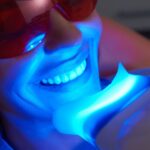 Achieve a Radiant Smile with Professional Laser Teeth Whitening Dallas TX