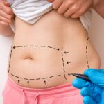 ACL Injury Treatment Dubai: Prevent Future Injuries with Targeted Rehabilitation