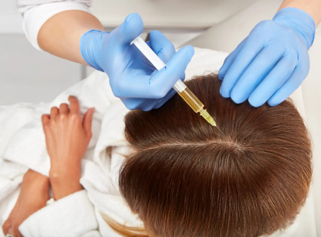 Benefits-Of-PRP-Hair-Restoration (1)