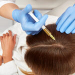 Benefits-Of-PRP-Hair-Restoration (1)