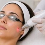 Laser Treatment in Dubai