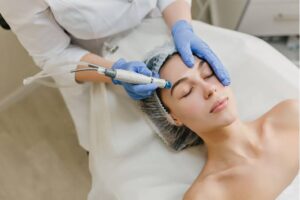 hydrodermabrasion facial edmonton